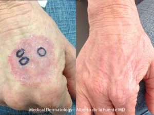 Medical Dermatology 1
